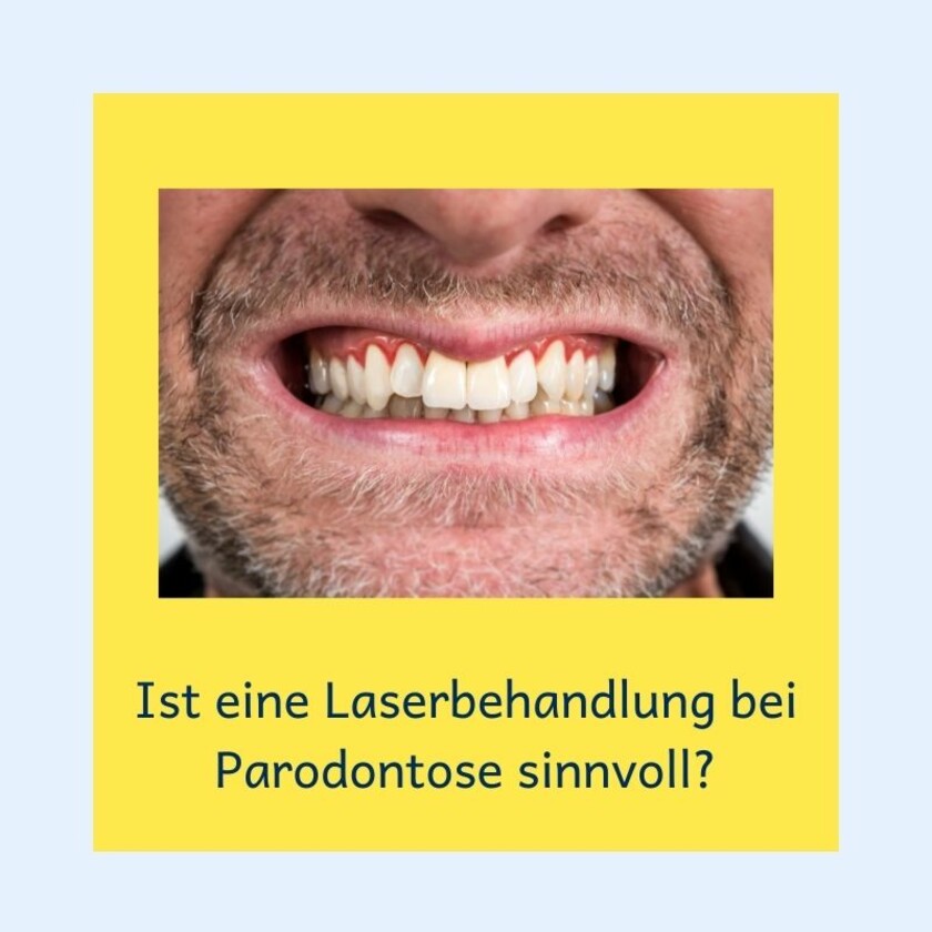 Dr Florian Neumayer Mannheim Ist eine Laserbehandlung bei Parodontose sinnvoll