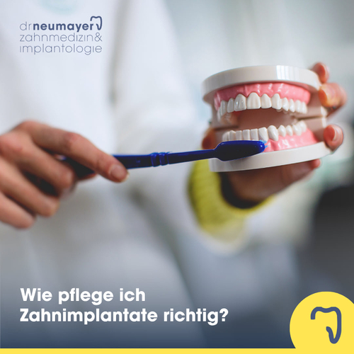 Wie pflege ich Zahnimplantate richtig?