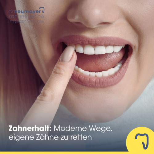 Zahnerhalt statt Zahnersatz:  Moderne Wege, eigene Zähne zu retten