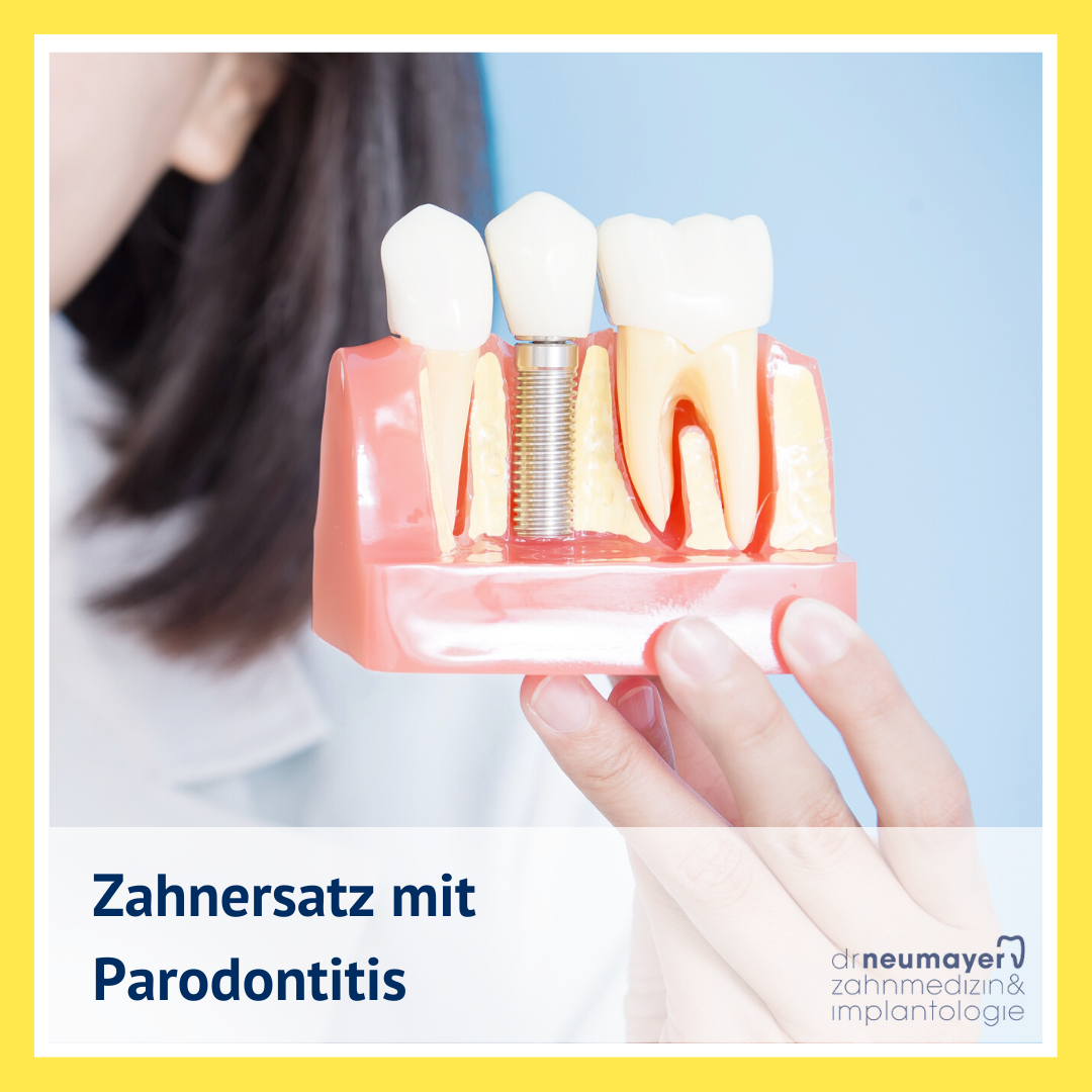 Zahnersatz Parodontitis Mannheim