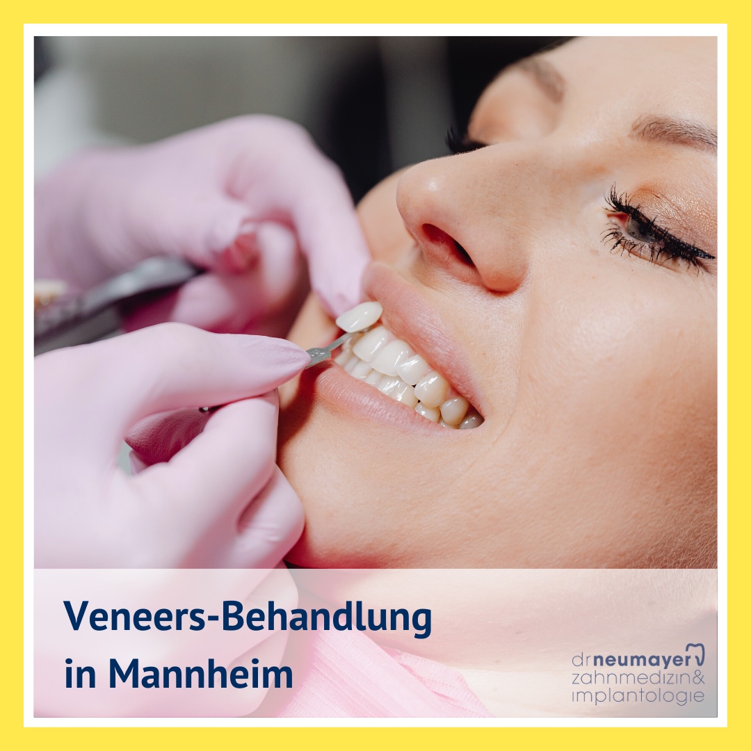 Die Veneers-Behandlung in Mannheim – so läuft sie ab