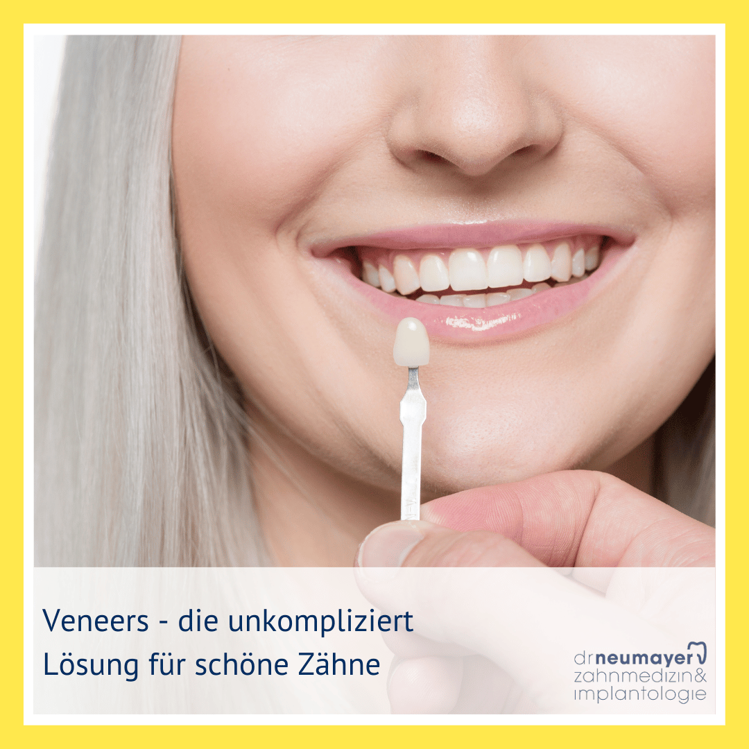 Veneers Mannheim