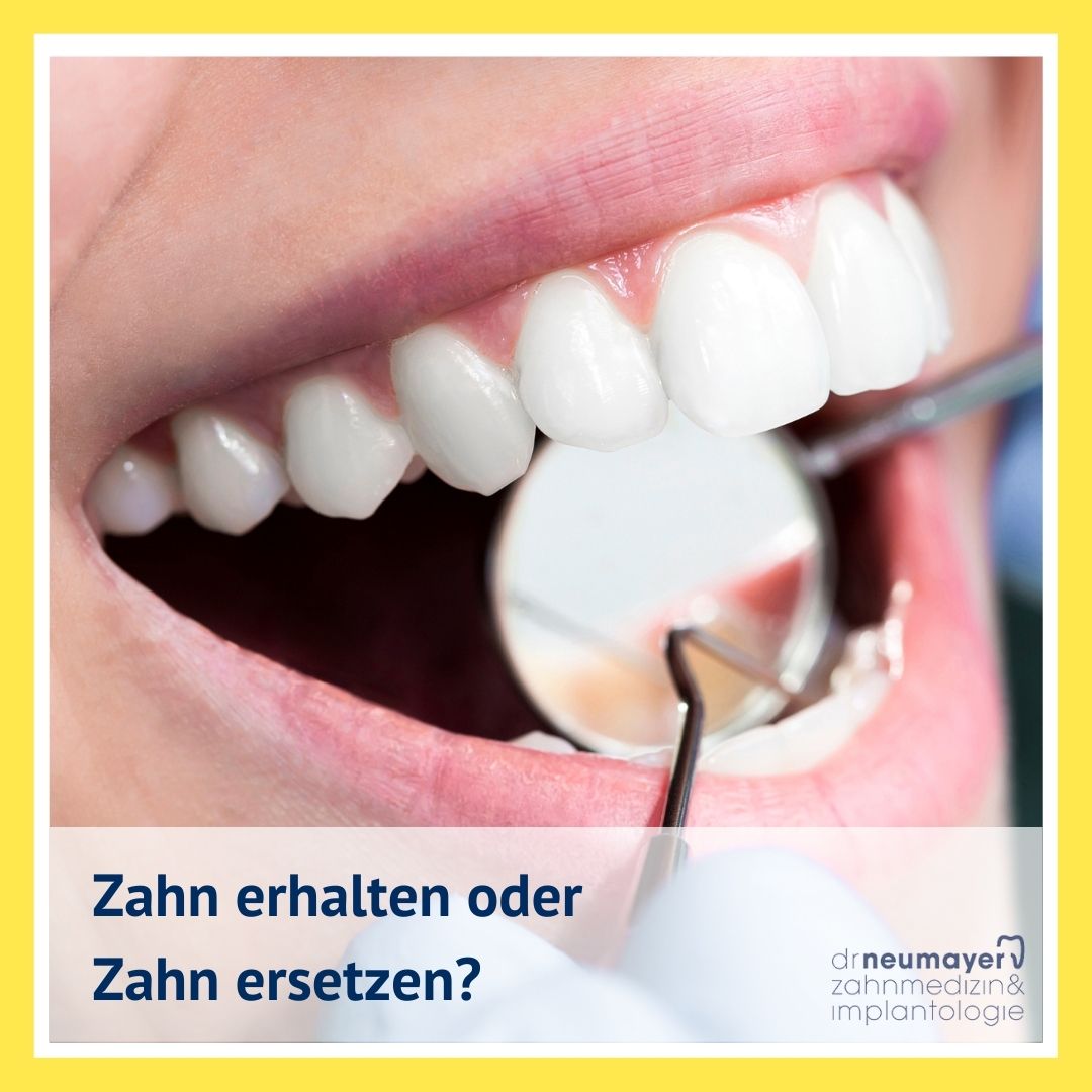 Wir können zahnlose Kiefer in einer Behandlungssitzung komplett mit festen dritten Zähnen versorgen 