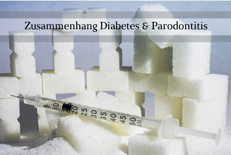 Zusammenhang Diabetes und Parodontitis | Zahnarzt Mannheim