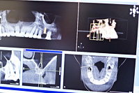 Zahnarzt Mannheim - DVT und digitales Röntgen