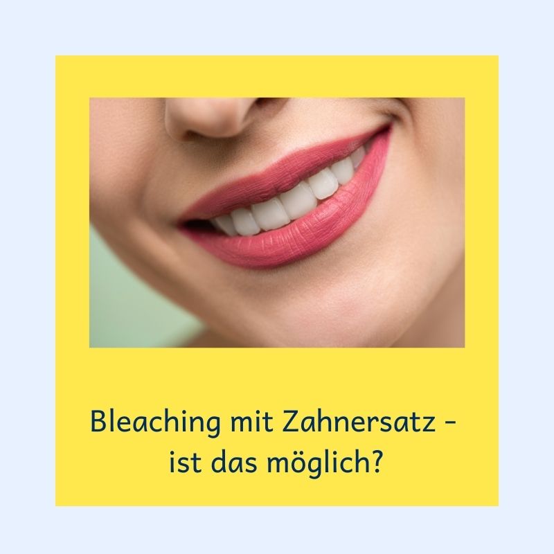 Bleaching und Zahnersatz oder Füllungen, passt das zusammen?