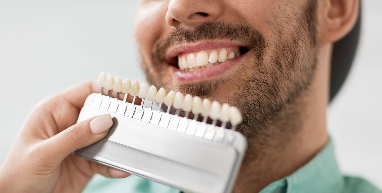 Veneers - Mann lächelt und bekommt die passenden Veneers