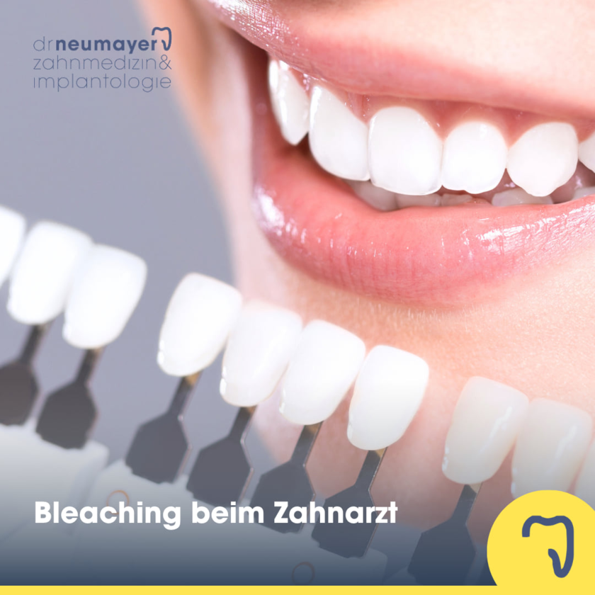 Bleaching bei Dr. Neumayer in Mannheim